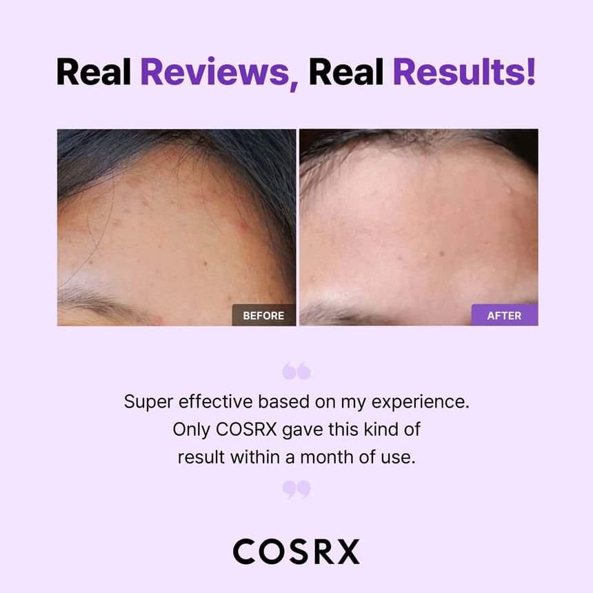 COSRX - AHA/BHA Clarifying Treatment Toner - Image 7