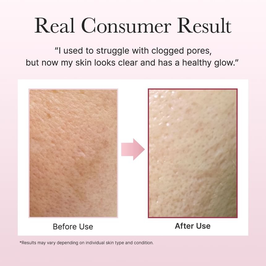 Arencia - Fresh Rosehip Rice Mochi Cleanser-5