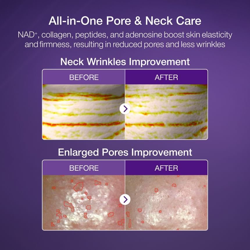 numbuzin - No.9 NAD Bio Lifting-sil Full Face Mask Set-5